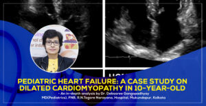 Pediatric Heart Failure: A Case Study on Dilated Cardiomyopathy in 10-Year-Old by Dr. Debasree Gangopadhyay, best Padiatric Cardiologist in Kolkata