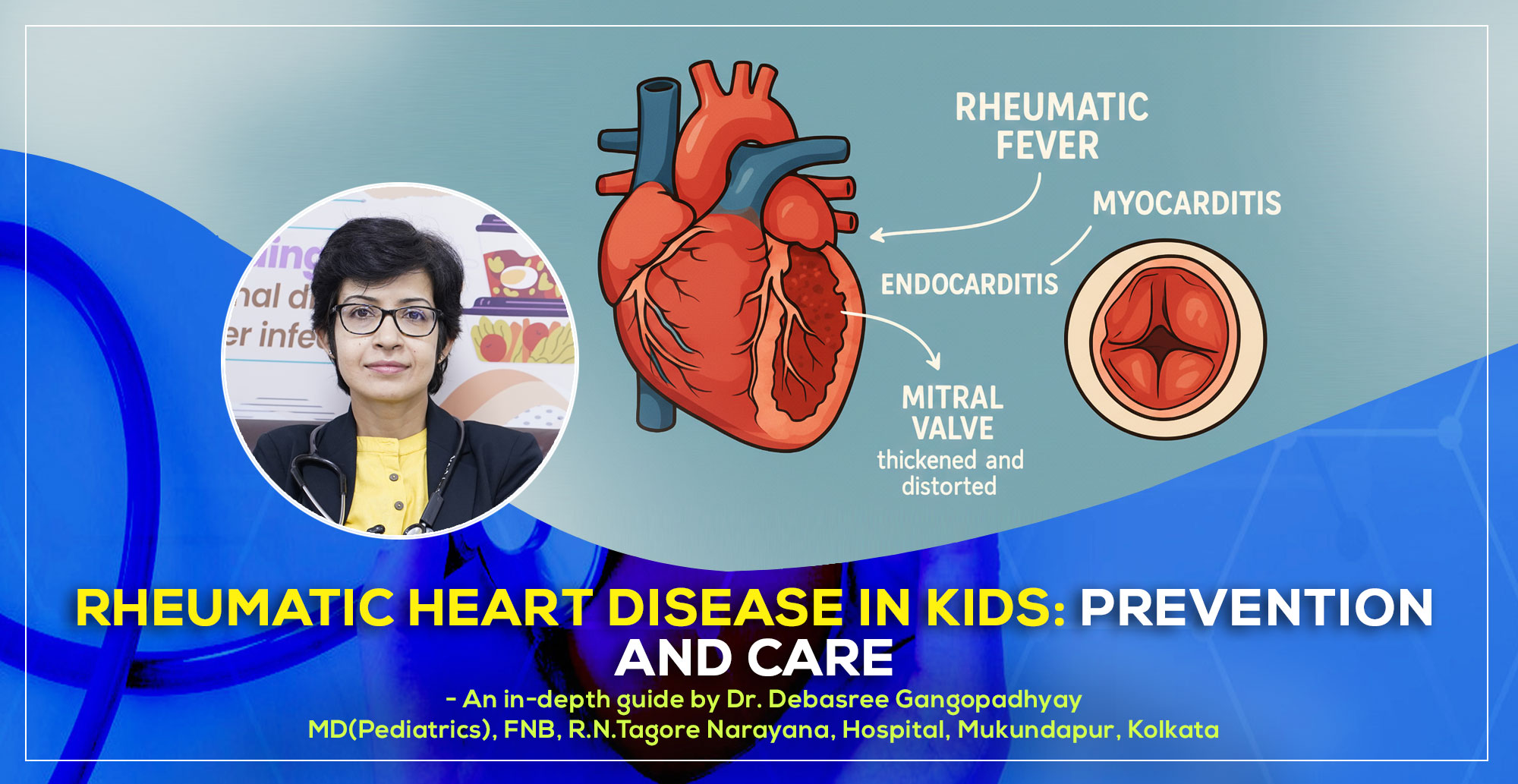 'A detailed discussion on ‘Rheumatic Heart Disease in Kids: Prevention and Care’ by Dr. Debasree Gangopadhyay, pediatric cardiologist, Narayana Hospital Kolkata