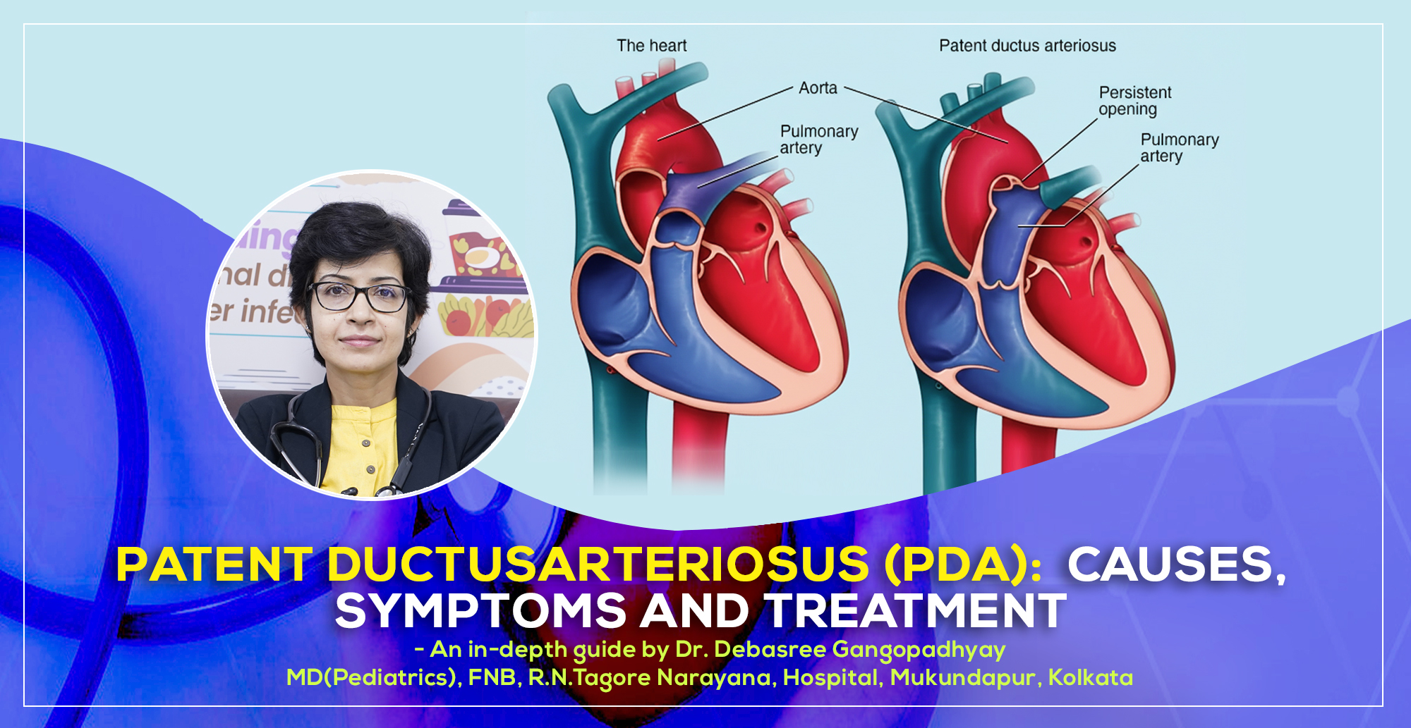 A detailed discussion on ‘Patent Ductus Arteriosus (PDA): Causes, Symptoms and Treatment in Kolkata' by Dr. Debasree Gangopadhyay, pediatric cardiologist (MD), Narayana Hospital, Mukundapur, Kolkata.